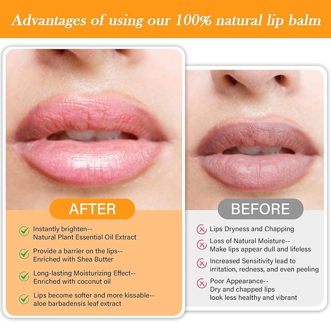 Yopela 221 Pack Natural Lip Balm Bulk - Image 6