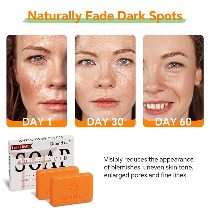 Kojic Acid and Turmeric Soap for Dark Spots Remover, Brightening, - Image 2