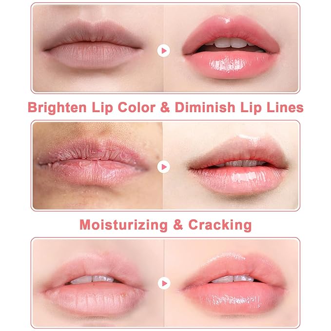 3 PCS Bee Lip Balm Mask Honey Pot, Watermelon, Cherry & Coconut Propolis - Image 4
