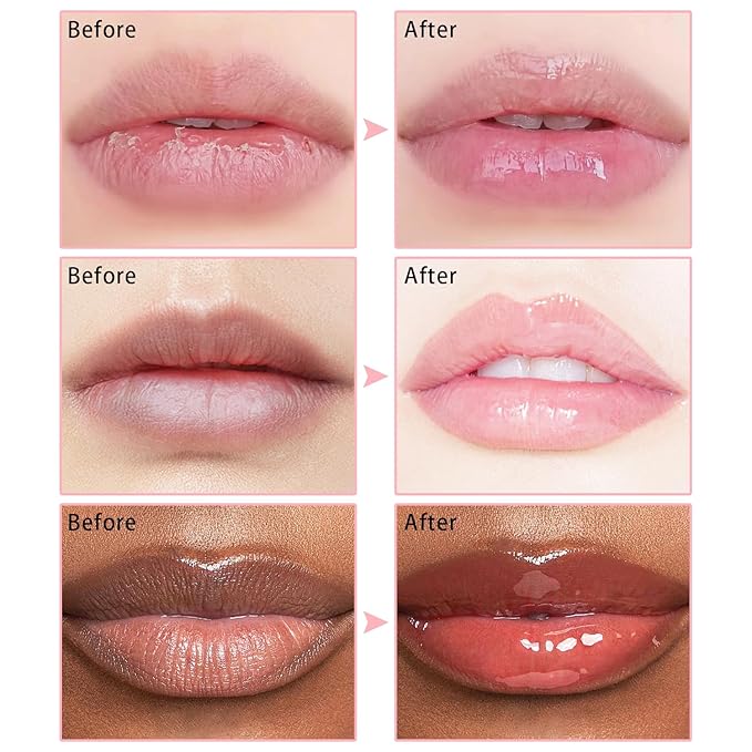 3 PCS Bee Lip Balm Lip Mask Honey Pot, Watermelon & Cherry & Coconut Lip Mask - Image 7